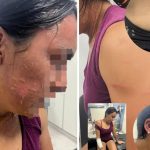 La hermana de un influencer tucumano fue atacada con agua hirviendo