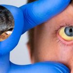 Alerta epidemiológica: Santa Fe lidera el preocupante aumento de casos de leptospirosis en la región Centro