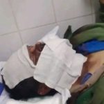 Un hombre sufrió graves quemaduras tras explotar un medidor eléctrico en pleno centro de Sáenz Peña
