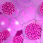 Crecen los casos de cáncer de cabeza y cuello asociados al VPH